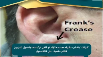 “فرانك” بالأذن: حقيقة صادمة تؤكد أو تنفي ارتباطها بتضيق شرايين القلب—تعرف على التفاصيل